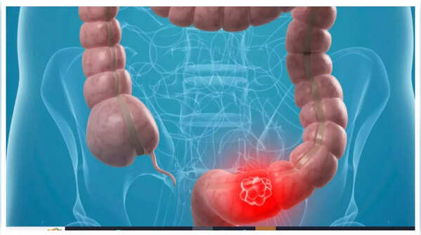 Illustration of abdominal pain.